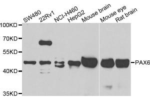 Western blot analysis of extracts of various cell lines, using PAX6 antibody (ABIN5975500) at 1/1000 dilution. (PAX6 Antikörper)