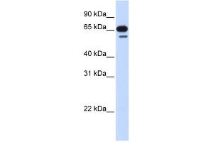 R3HDM2 antibody used at 1 ug/ml to detect target protein. (R3HDM2 Antikörper  (Middle Region))