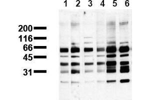 Western Blotting (WB) image for anti-Phosphoserine (phosphorylated) antibody (ABIN126863) (Phosphoserine Antikörper  (phosphorylated))