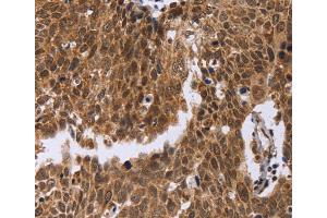 Immunohistochemistry (IHC) image for anti-Excision Repair Cross-Complementing Rodent Repair Deficiency, Complementation Group 6-Like (ERCC6L) antibody (ABIN2423388) (ERCC6L Antikörper)