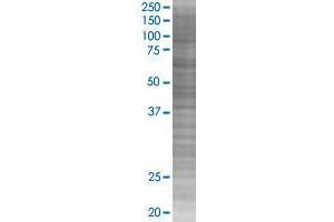 GYG2 transfected lysate. (GYG2 293T Cell Transient Overexpression Lysate(Denatured))