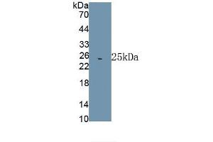Detection of Recombinant HSPA5, Rat using Polyclonal Antibody to Heat Shock 70 kDa Protein 5 (HSPA5) (GRP78 Antikörper  (AA 260-469))