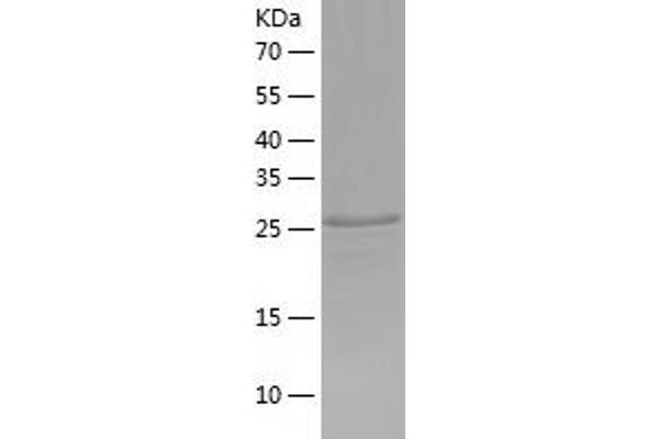 FCRL6 Protein (AA 20-307) (His tag)