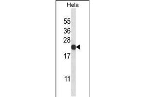Western blot analysis in Hela cell line lysates (35ug/lane). (PSMB5 Antikörper  (C-Term))