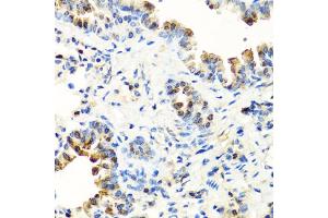 Immunohistochemistry of paraffin-embedded mouse lung using SERPINA7 antibody. (SERPINA7 Antikörper)