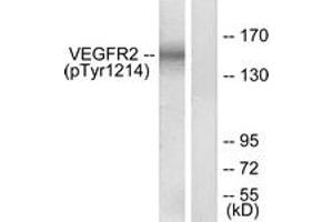 Western Blotting (WB) image for anti-VEGF Receptor 2 (VEGFR2) (pTyr1214) antibody (ABIN2888556) (VEGFR2/CD309 Antikörper  (pTyr1214))