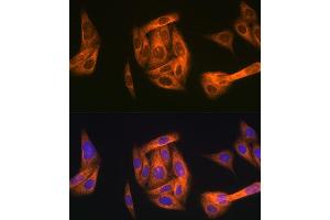 Immunofluorescence analysis of U-2 OS cells using T Rabbit mAb (ABIN1680832, ABIN7101518, ABIN7101519 and ABIN7101520) at dilution of 1:100 (40x lens). (TAB1 Antikörper)