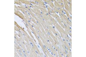 Immunohistochemistry of paraffin-embedded rat heart using CRHBP antibody. (CRHBP Antikörper)