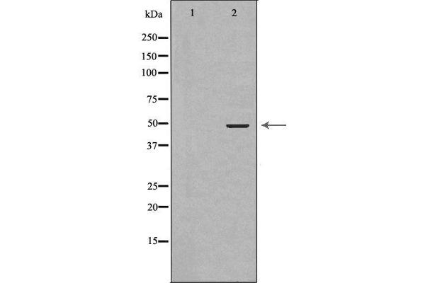 GSK3 beta Antikörper  (N-Term)