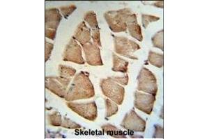 GSN Antibody (C-term) (R) IHC analysis in formalin fixed and paraffin embedded human Skeletal muscle tissue followed by peroxidase conjugation of the secondary antibody and DAB staining. (Gelsolin Antikörper  (C-Term))