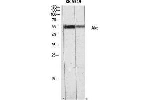 Western Blotting (WB) image for anti-V-Akt Murine Thymoma Viral Oncogene Homolog 1 (AKT1) (Internal Region) antibody (ABIN6283882) (AKT1 Antikörper  (Internal Region))