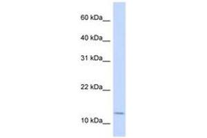 Image no. 1 for anti-Cellular Retinoic Acid Binding Protein 2 (CRABP2) (AA 72-121) antibody (ABIN6743084) (CRABP2 Antikörper  (AA 72-121))