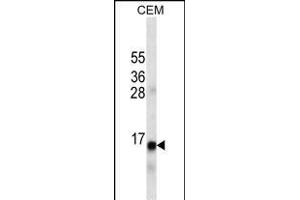 INS Antibody ABIN1539839 western blot analysis in CEM cell line lysates (35 μg/lane). (Insulin Antikörper  (AA 35-64))