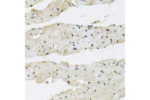 Immunohistochemistry of paraffin-embedded rat heart using SFRS9 antibody. (SFRS9 Antikörper)