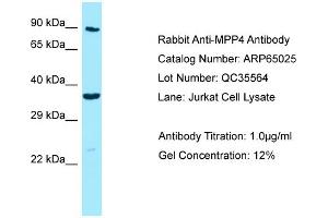 Western Blotting (WB) image for anti-Membrane Protein, Palmitoylated 4 (MAGUK P55 Subfamily Member 4) (MPP4) (C-Term) antibody (ABIN971167) (MPP4 Antikörper  (C-Term))