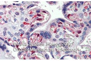 Rabbit Anti-NOL5A Antibody ,Paraffin Embedded Tissue: Human Placenta  Antibody Concentration: 5 µg/mL (NOP56 Antikörper  (Middle Region))