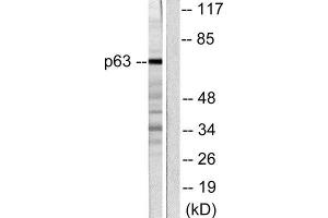 Western Blotting (WB) image for anti-T-Complex 1 (TCP1) (C-Term) antibody (ABIN1848723) (TCP1 alpha/CCTA Antikörper  (C-Term))