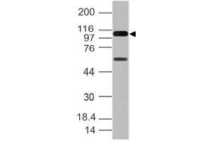Image no. 1 for anti-DEAD (Asp-Glu-Ala-Asp) Box Polypeptide 58 (DDX58) (AA 1-220) antibody (ABIN5027276) (DDX58 Antikörper  (AA 1-220))