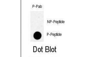 Dot Blot (DB) image for anti-TBK (pSer172) antibody (ABIN3001894) (TBK (pSer172) Antikörper)