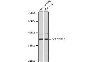 Western blot analysis of extracts of various cell lines, using CCR2/CKR2 antibody (ABIN7266304) at 1:1000 dilution. (CCR2 Antikörper)