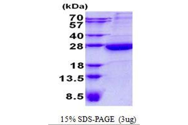 HEBP1 Protein (His tag)