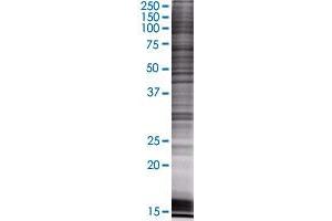 Western Blotting (WB) image for B4GALNT1 293T Cell Transient Overexpression Lysate(Denatured) (ABIN1331900)