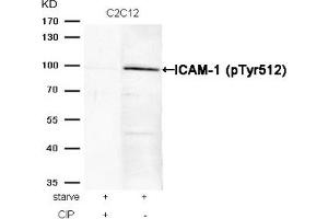 Western blot analysis of extracts from C2C12 cells, treated with starve or calf intestinal phosphatase (CIP), using ICAM-1 (Phospho-Tyr512) Antibody. (ICAM1 Antikörper  (pTyr512))