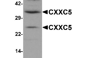 Western Blotting (WB) image for anti-CXXC Finger Protein 5 (CXXC5) (N-Term) antibody (ABIN1031339) (CXXC5 Antikörper  (N-Term))