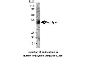 Image no. 1 for anti-Podocalyxin-Like (PODXL) (AA 100-200), (Internal Region) antibody (ABIN363564) (PODXL Antikörper  (Internal Region))