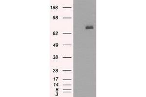 Western Blotting (WB) image for anti-Bruton Agammaglobulinemia tyrosine Kinase (BTK) antibody (ABIN1496977) (BTK Antikörper)