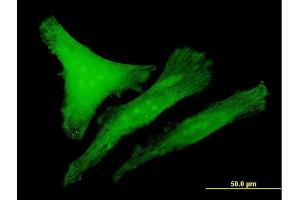 Immunofluorescence of purified MaxPab antibody to CDKN1B on HeLa cell. (CDKN1B Antikörper  (AA 1-198))