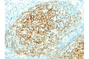 Image no. 1 for anti-Vascular Cell Adhesion Molecule 1 (VCAM1) antibody (ABIN6157708) (VCAM1 Antikörper)
