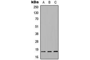 Western blot analysis of Alpha-synuclein expression in HEK293T (A), Raw264. (SNCA Antikörper  (Center))