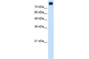 WB Suggested Anti-CDH3 Antibody Titration:  1. (P-Cadherin Antikörper  (N-Term))