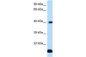 WB Suggested Anti-CD1D Antibody Titration: 1. (CD1d Antikörper  (C-Term))