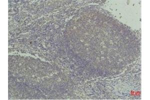 Immunohistochemistry (IHC) analysis of paraffin-embedded Human Tonsil Tissue using TNF a Mouse Monoclonal Antibody diluted at 1:50. (TNF alpha Antikörper)