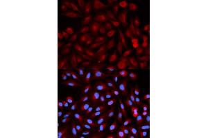 Immunofluorescence analysis of HeLa cells using PSME3 antibody (ABIN5970101). (PSME3 Antikörper)