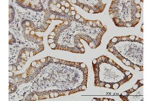 Immunostaining (ISt) image for anti-Leucine Zipper-EF-Hand Containing Transmembrane Protein 1 (LETM1) (AA 601-708) antibody (ABIN561659)