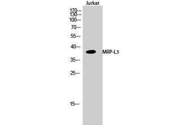 MRPL38 Antikörper  (Internal Region)