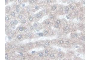 DAB staining on IHC-P; Samples: Rat Liver Tissue) (ORM1 Antikörper  (AA 19-186))