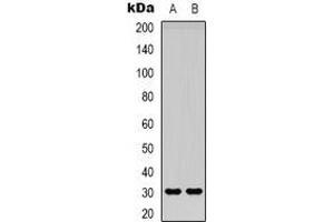 Western blot analysis of Adiponectin expression in Hela (A), HEK293T (B) whole cell lysates. (ADIPOQ Antikörper)