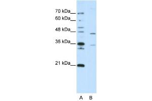 ZNF488 antibody (20R-1241) used at 0. (ZNF488 Antikörper  (C-Term))