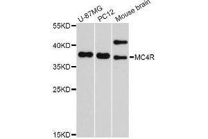 Western blot analysis of extracts of various cell lines, using MC4R Antibody. (MC4R Antikörper  (AA 1-100))