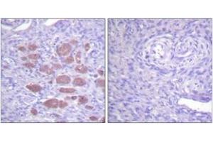 Immunohistochemistry (IHC) image for anti-Neutrophil Cytosolic Factor 4, 40kDa (NCF4) (AA 120-169) antibody (ABIN2888743) (NCF4 Antikörper  (AA 120-169))
