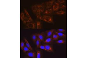 Immunofluorescence analysis of U-2 OS cells using HSP27/HSPB1Rabbit mAb (ABIN7267569) at dilution of 1:100 (40x lens). (HSP27 Antikörper)