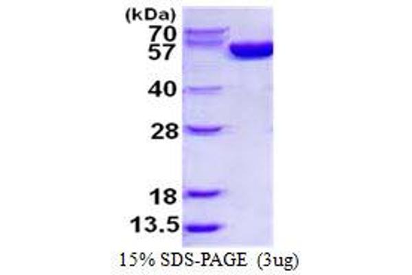 Glucose-6-Phosphate Dehydrogenase Protein (G6PD) (His tag)