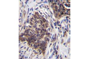 Immunohistochemistry (IHC) image for anti-Glucosidase, Alpha, Acid (GAA) antibody (ABIN2996809) (GAA Antikörper)