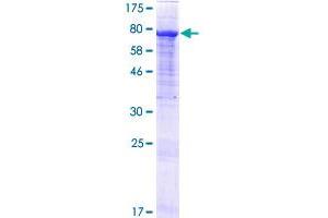 Image no. 1 for GTF2I Repeat Domain Containing 2 (GTF2IRD2) (AA 1-498) protein (GST tag) (ABIN1306165) (GTF2IRD2 Protein (AA 1-498) (GST tag))