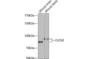 Western blot analysis of extracts of various cell lines, using CLCN2 Antibody (ABIN6133641, ABIN6138663, ABIN6138664 and ABIN6221716) at 1:1000 dilution. (CLCN2 Antikörper  (C-Term))