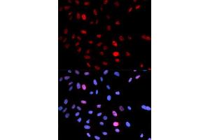 Immunofluorescence analysis of U2OS cells using Phospho-SMC1A-S957 antibody (ABIN5969934). (SMC1A Antikörper  (pSer957))